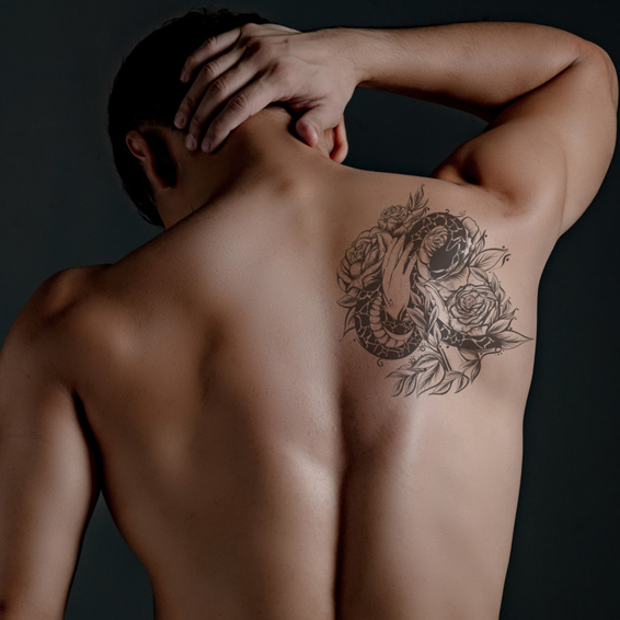 Tatoo Removal treatemnt by Pure Wellness Clinic